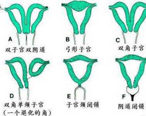 上海代孕试管代孕可以龙凤胎吗,天津为什么三代试管不能双胎,上海助孕公司哪