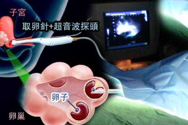 怎样评选上海试管辅助中心排名榜前十名？,2023年在上海国际医学中心做试管婴