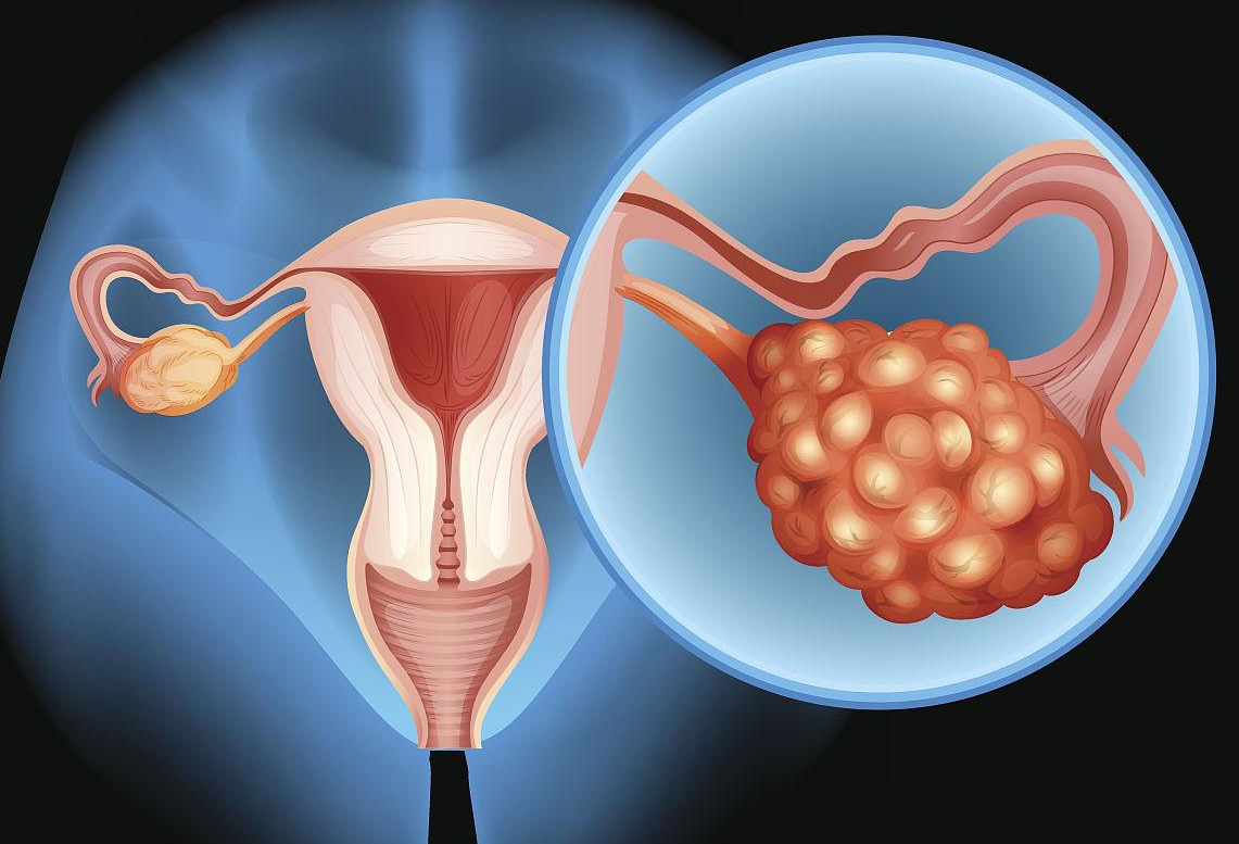 招代孕孕母[精因宝贝生殖中心微信号],宣城三代试管能避免哪些遗传疾病