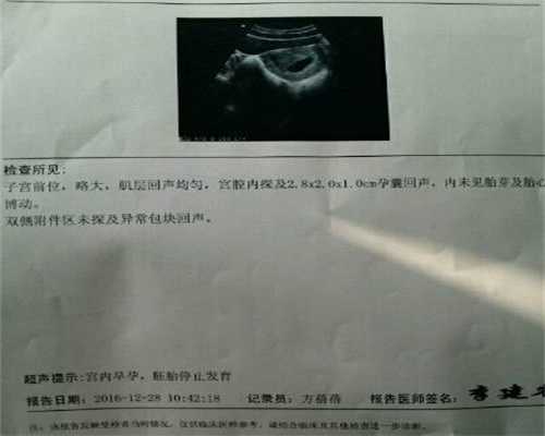 上海代孕去可以吗_上海哪里可以帮人代孕_环球宝贝怎么样-输卵管手术是大手术