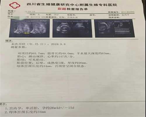上海试管助孕中心_上海代孕生小孩可信吗_柬埔寨皇家生殖医院-做完输卵管通液