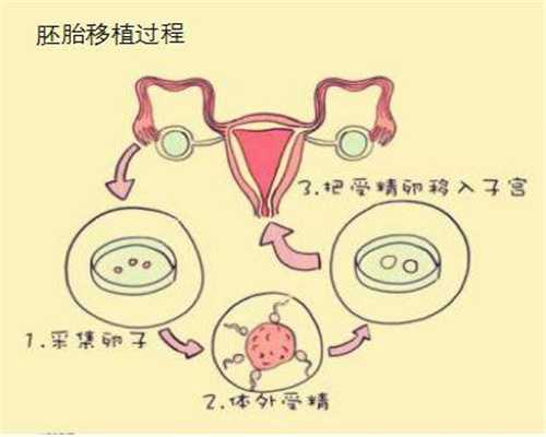 上海代孕产子预约电话_上海代孕中介费_天若助孕-输卵管积水症状是什么原因
