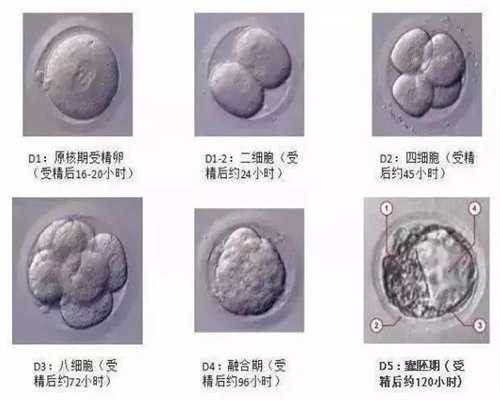 上海人工代孕的流程_上海代孕一般价钱_泰嘉运的骗局-孕妇第一个月吃什么补充