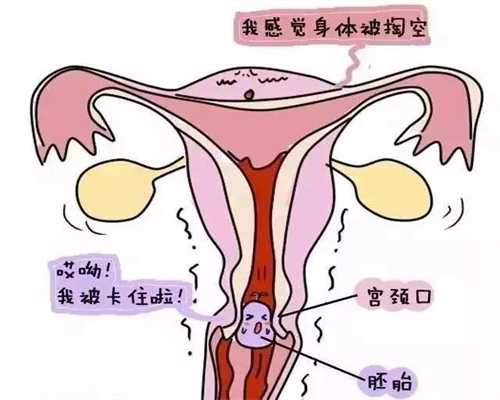 上海代孕生子可靠吗_上海哪里有招代孕妈妈的