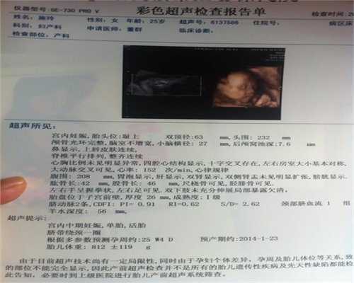 上海三代试管婴儿包儿子_上海第三代试管婴儿hcg