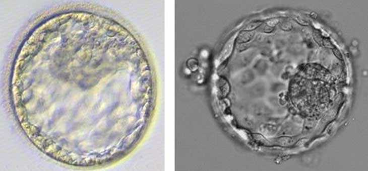 精因宝贝生殖中心微信号[供卵试管贴吧]+试管婴儿胚胎选哪种好？该怎么选择？