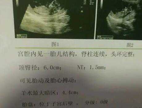 上海合法供卵医院数量-上海合法供卵医院