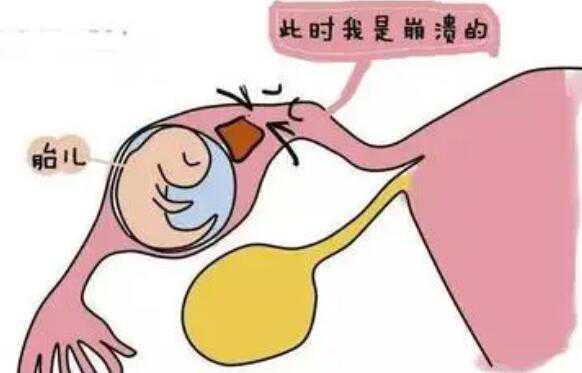 上海瑞金医院供卵的卵源好吗？不排异成功着床几率高吗？